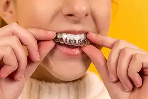 一般歯科の写真